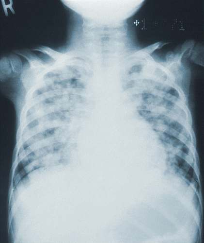 medical imaging x-ray film person in black and white plaid shirt ct scan